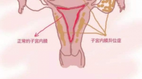 子宫内膜薄月经少怎么调理