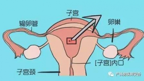 产后恶露什么时候干净才算正常？
