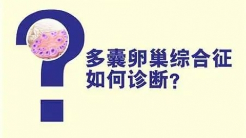 多囊卵巢一定就是多囊卵巢综合征吗？