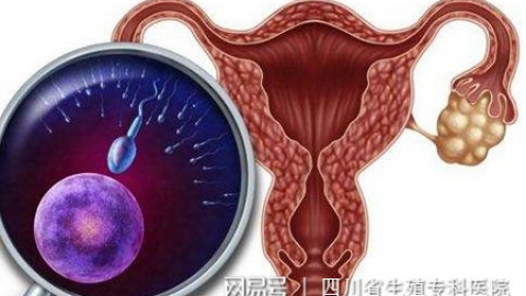 为什么越来越多年轻女孩子惹上“多囊卵巢”？专家直指这两大因素