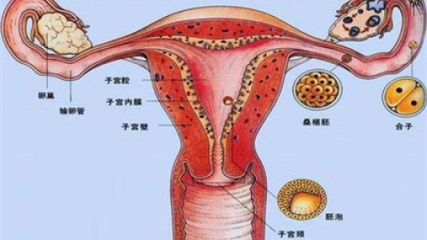 子宫腺肌症的饮食注意事项