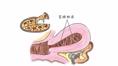 宫腔黏连做试管婴儿成功几率大吗？会有什么影响?