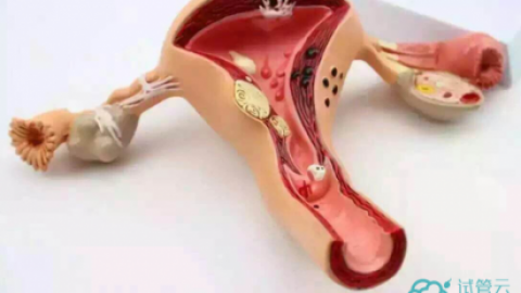 窦卵泡计数