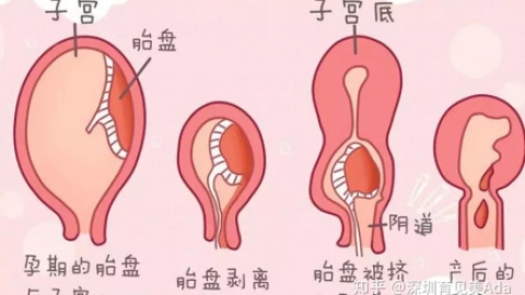 秒懂产后恶露
