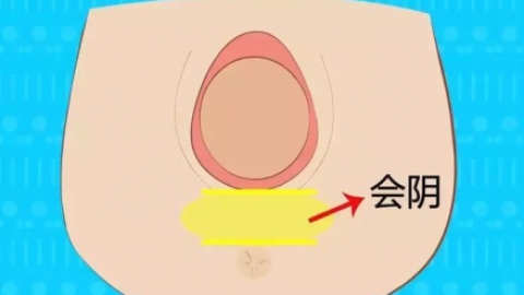 顺产侧切到底怎么切？产科医生揭秘侧切全过程！