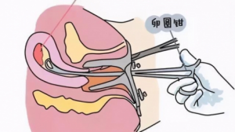 小月子的注意事项有什么？小月子应该怎么调理？