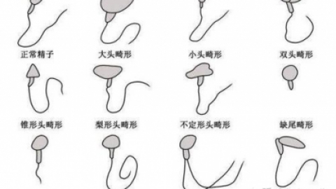 什么是弱精症