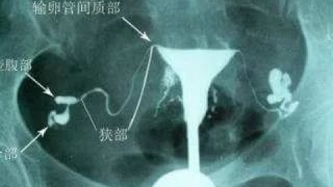 输卵管造影是什么？输卵管造影的5大危害你了解吗！