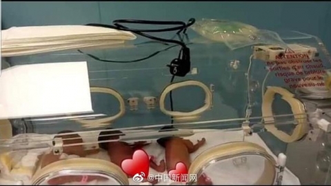 非洲一女子生下9胞胎破世界纪录！你了解多胎妊娠的风险么？