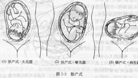 双胎妊娠,不仅是多一个BB
