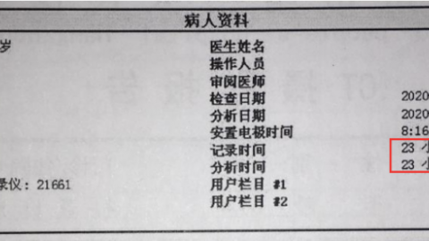 短QT间期综合征 丁香园用药助手