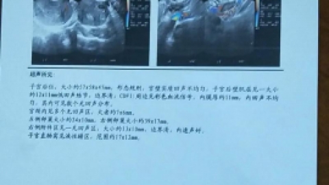 hcg正常值_hcg是什么意思_医药卫生_专业资料