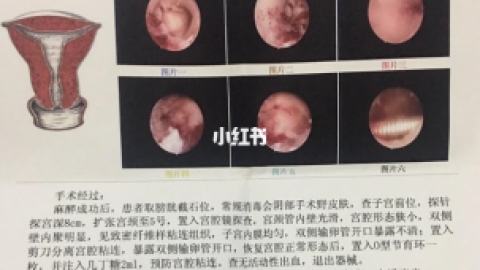 > 宫腔镜检查与治疗