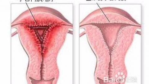 【图文】子宫内膜厚度多少正常