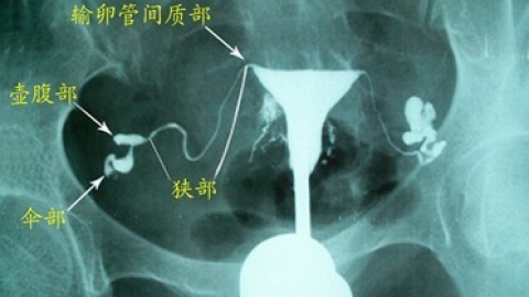 拱墅区输卵管堵塞造影多少钱近的医院？杭州仁德妇产医院好不好