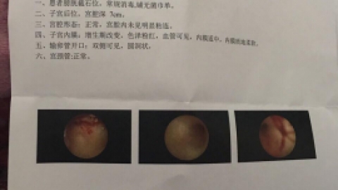 宫腔镜检查，分享我的经历给大家