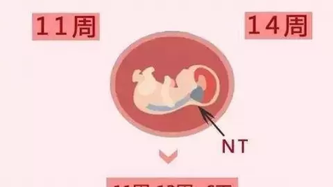 nt检查 NT检查和B超有什么区别? 原来分别是这么回事, 孕妇一定要分清