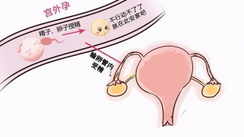 hcg