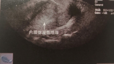 2010 获得性长QT间期综合征的防治建议
