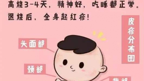 关于“幼儿急疹”的知识全在这里