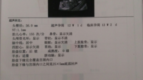 nt检查 NT检查_基础医学_医药卫生_专业资料