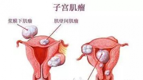 宫腔镜检查是什么