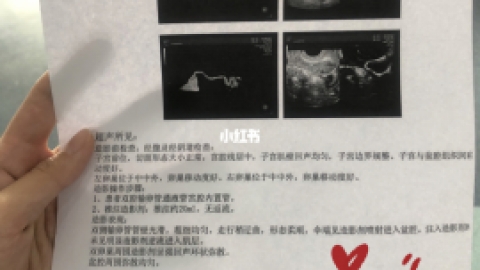 什么是输卵管造影 做输卵管造影有哪些危害