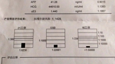 唐氏综合症筛查.doc