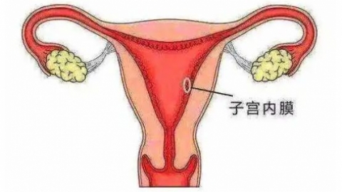 子宫内膜薄的原因以及该如何调理。