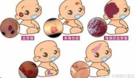 唐氏综合症会引发什么疾病？