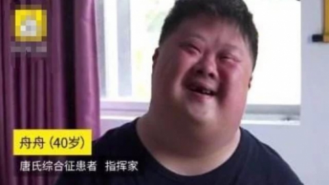 唐氏综合症产前筛查