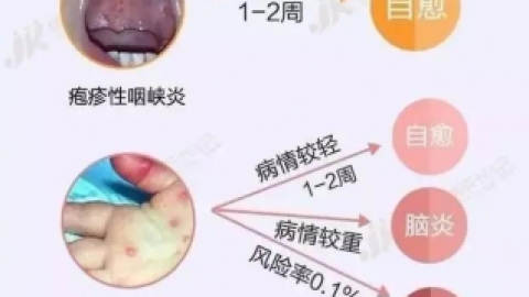 【单纯疱疹病毒感染】什么是单纯疱疹病毒感染