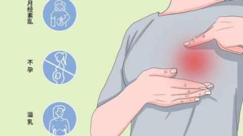 ​女性催乳素偏高的原因是什么