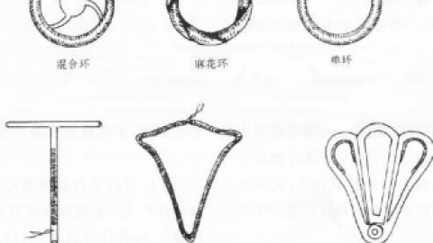 得了子宫腺肌症，上环就能治好吗？