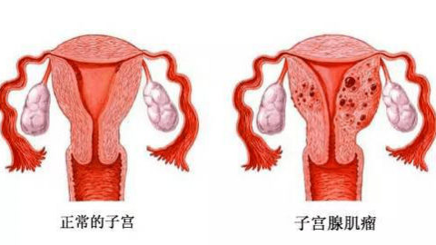 宫腔镜十问十答