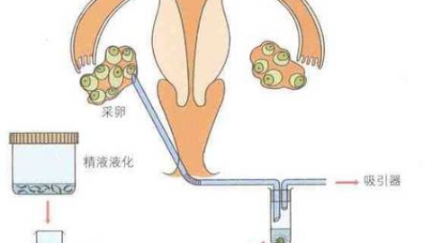 黄体期长方案，适合你吗？