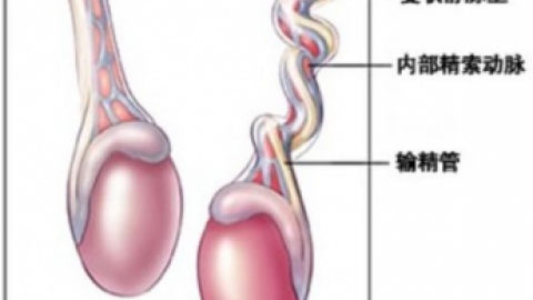 睾丸扭转的病因，睾丸扭转有哪些原因