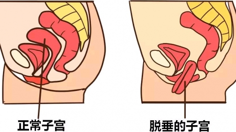 小月子注意事项有哪些？
