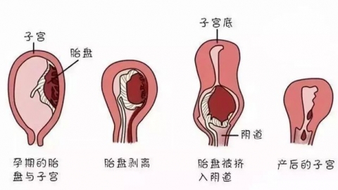 产后恶露干净后又来该怎么办