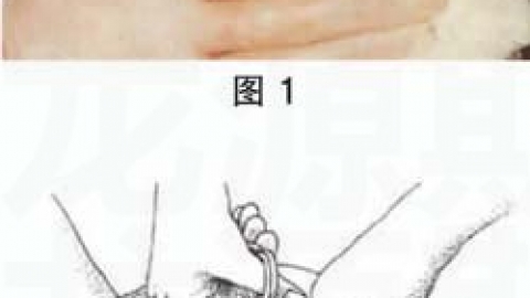 会阴侧切的术后护理及并发症处理方法(期刊论文)