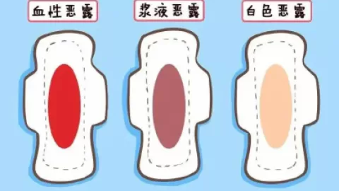 产后恶露3周才干净 这些方法助你排恶露
