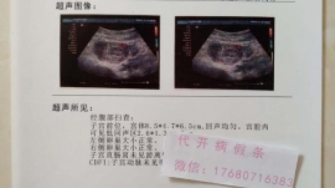 唐氏综合症产前筛查方法