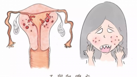 子宫腺肌症对身体有哪些方面的伤害？