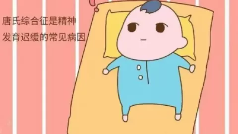 唐氏综合症科普_基础医学_医药卫生_专业资料