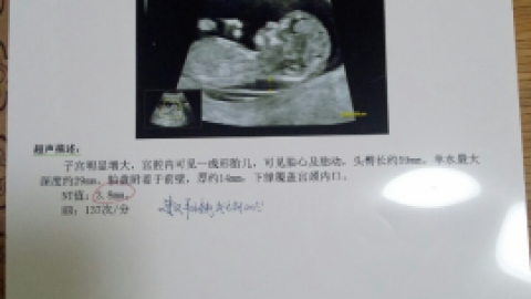 NT检查多少钱