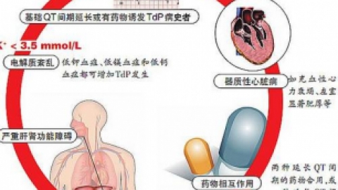 qt间期延长是什么意思