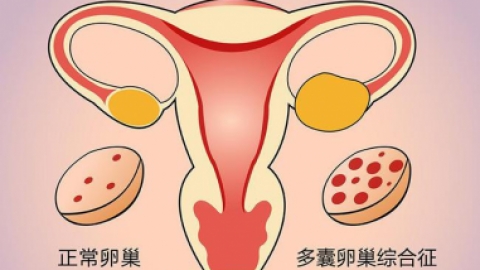 泉州不孕不育医院