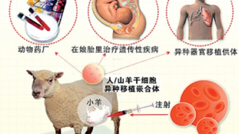 马凡氏综合征遗传规律  什么是马凡氏综合症更新时间:2018-12-30