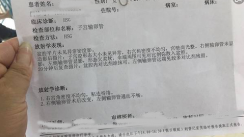 子宫输卵管造影检查多少钱?无痛子宫输卵管造影免费检查了!