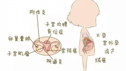 雌激素低的原因 这些因素导致雌激素低